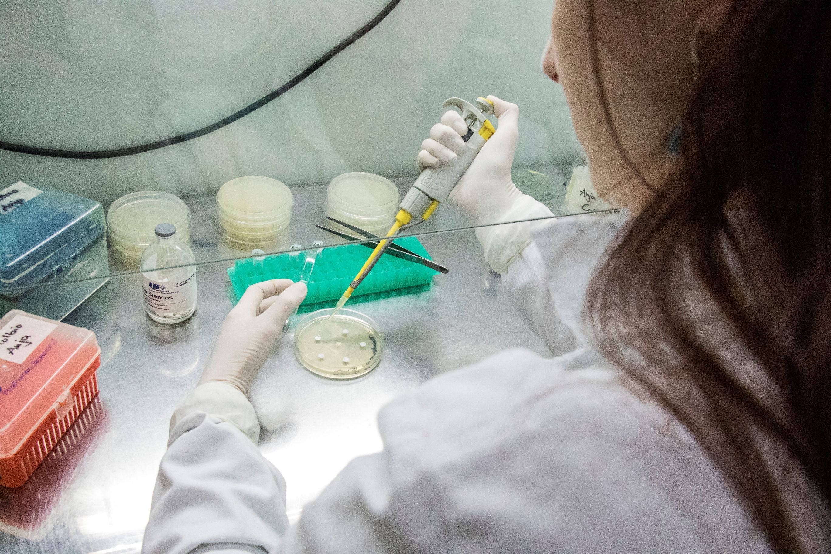 Univates seleciona bolsista para projeto de pesquisa sobre aproveitamento do soro de queijo para produção de suplementos nutracêuticos