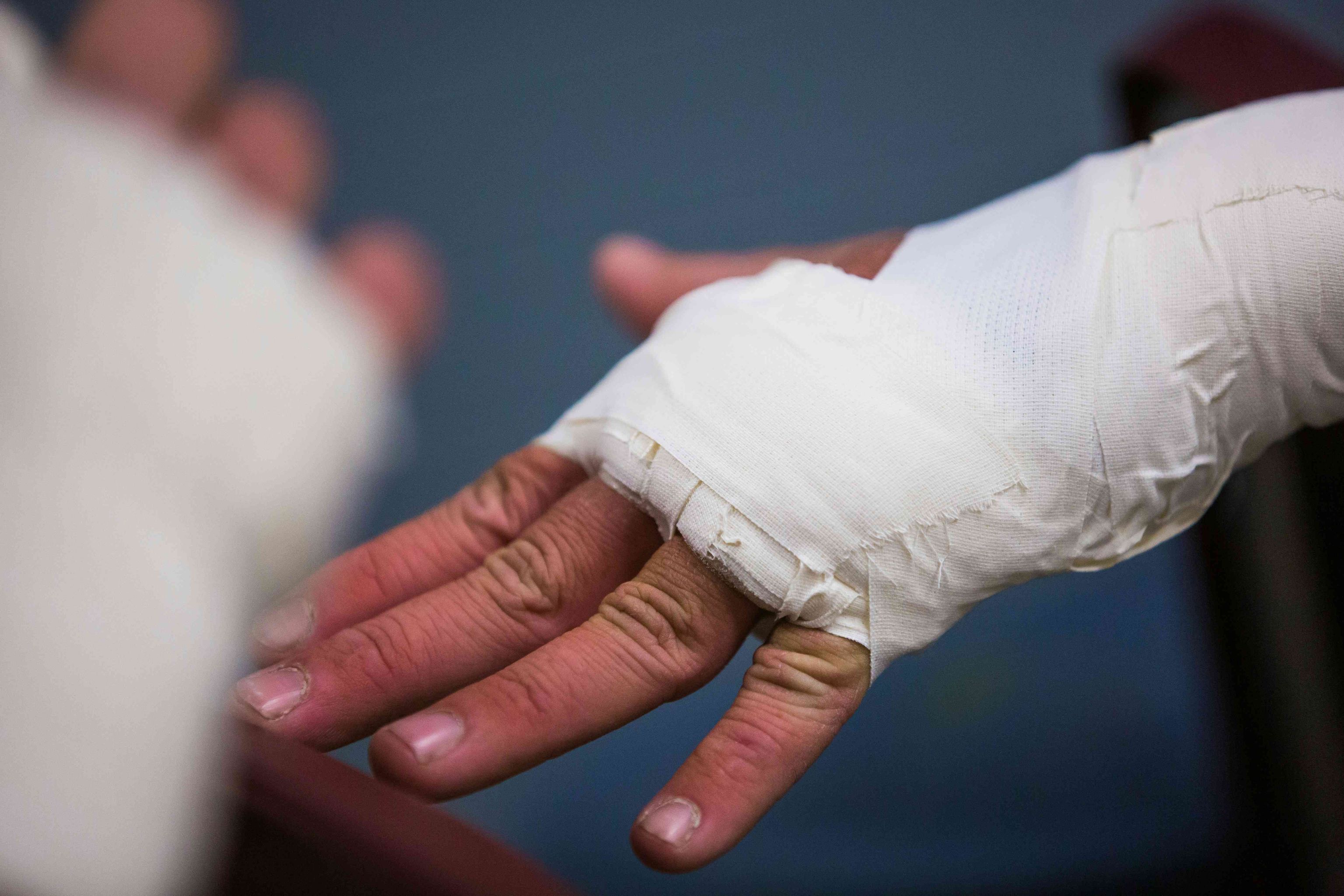 Ambulatório da Univates oferece tratamento gratuito para pessoas do Vale do Taquari com feridas crônicas