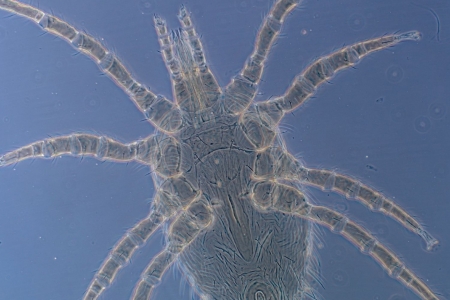 Primeiro registro de parasitismo de caros da espcie Ornithonyssus bursa em humanos no Vale do Taquari  realizado por pesquisadores da Univates