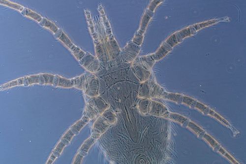 Primeiro registro de parasitismo de �caros da esp�cie Ornithonyssus bursa em humanos no Vale do Taquari � realizado por pesquisadores da Univates